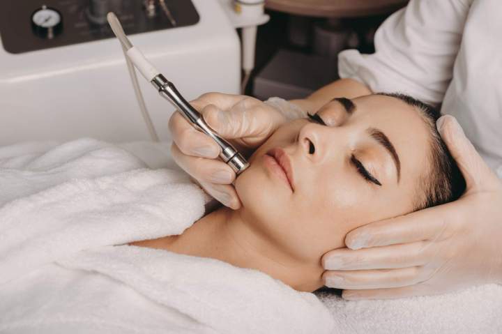 Traitement microneedling visage Saint Jérôme