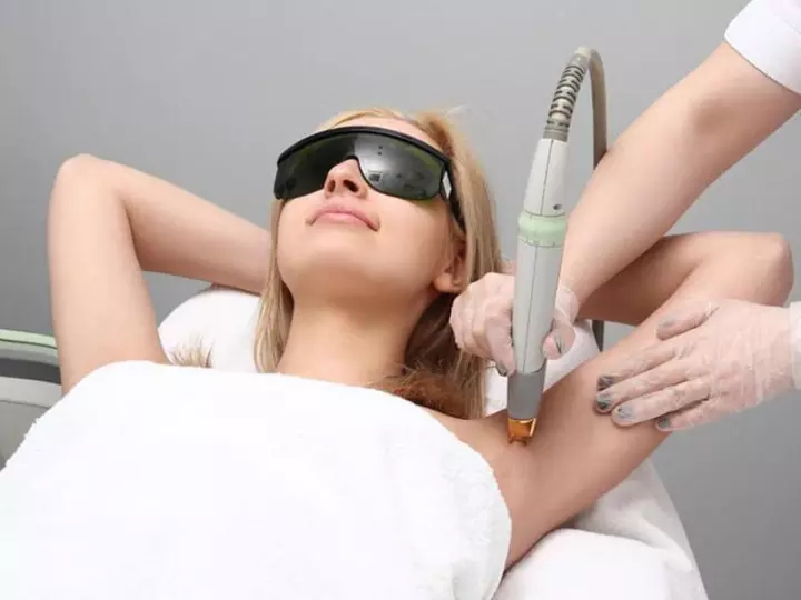 Épilation au laser, Laval