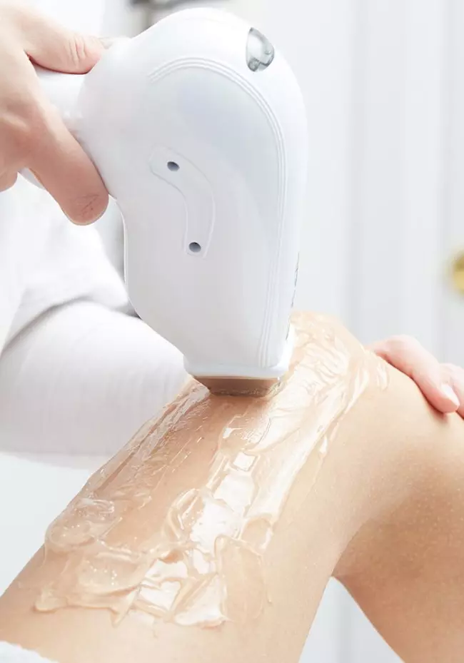 Épilation au laser, Terrebonne